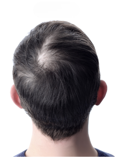 image comparison before